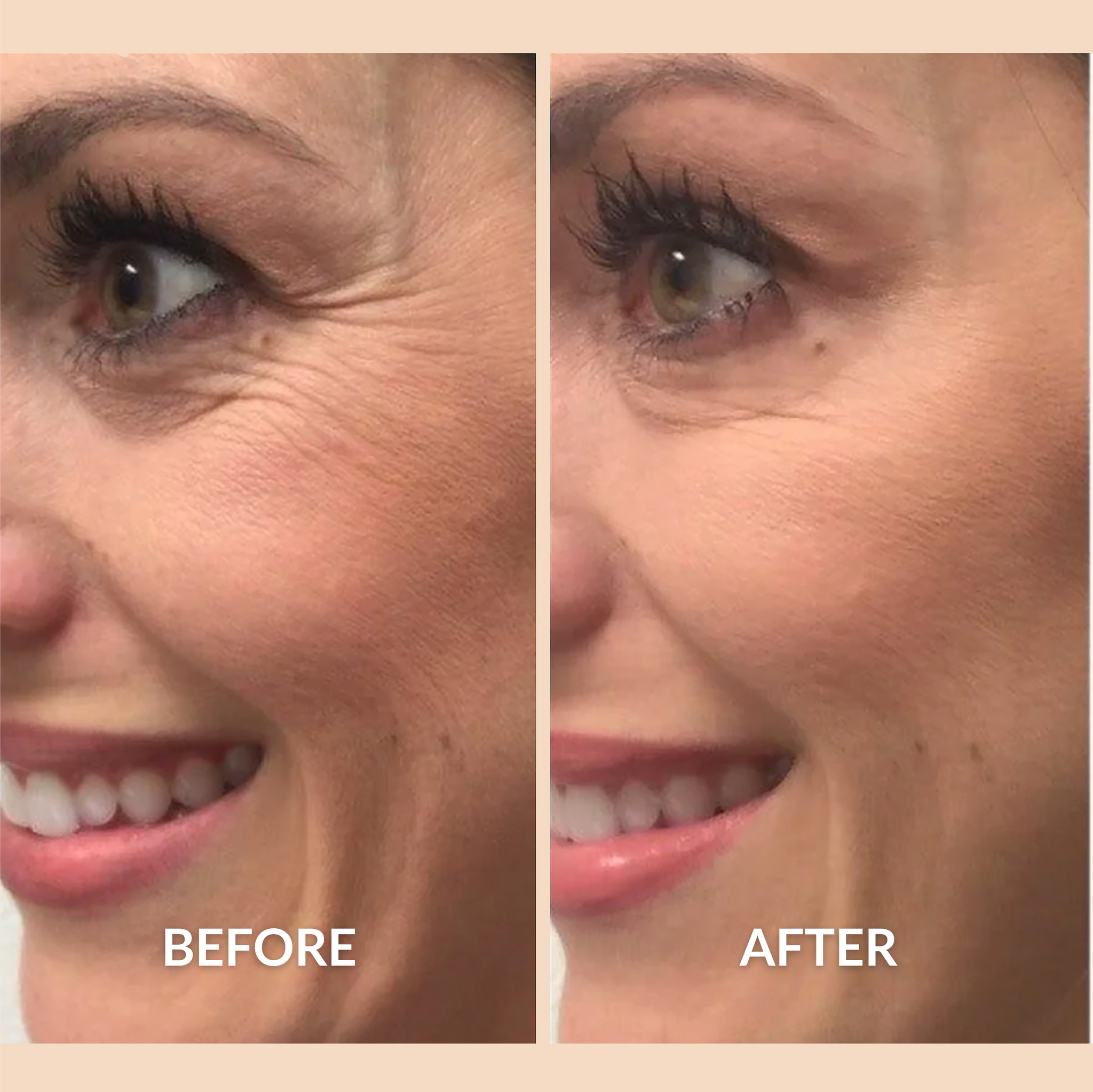 Silicone Scar Repair Tape