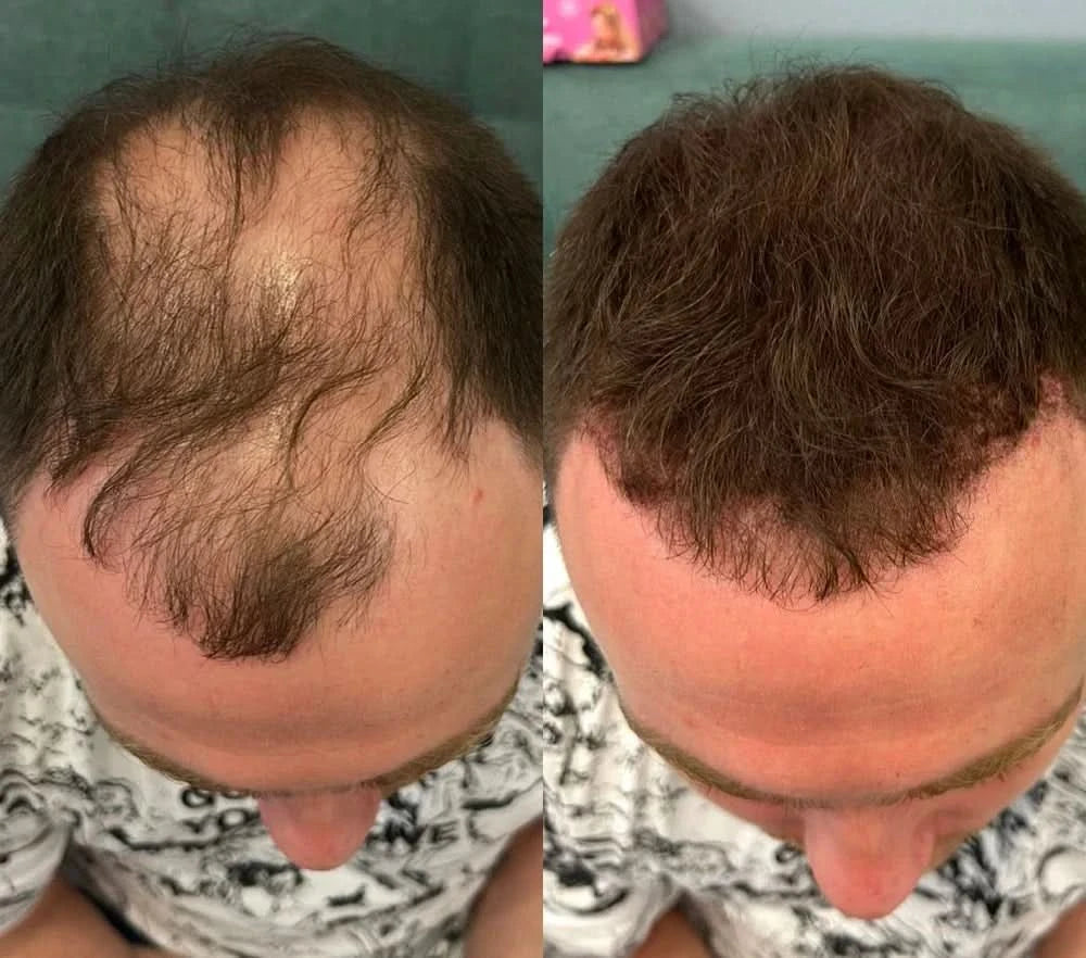 Densify Instant Hair Cover