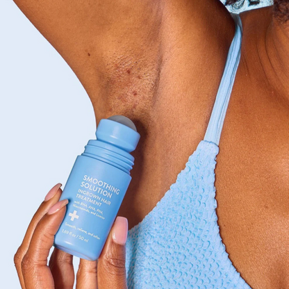SmoothGuard Ingrown Hair Fix Roll-On