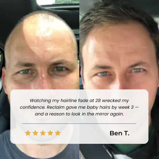 Growth Roll-On Serum